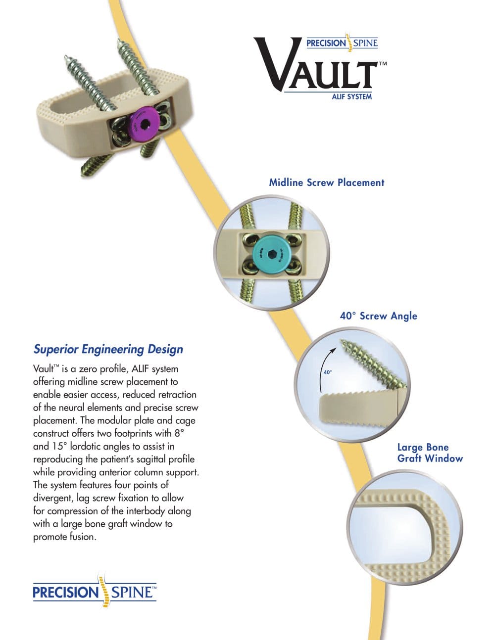Vault